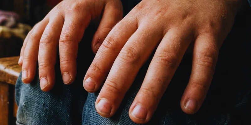 Daños de morderse las uñas en niños: consecuencias visibles